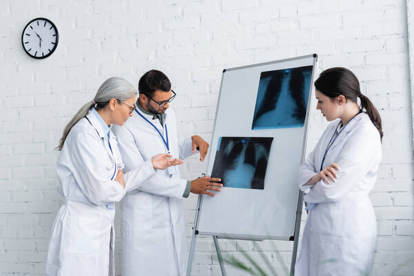 Азиатский врач средних лет указывает на флюорографию легких вблизи молодых врачей
