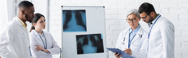mature asian doctor pointing at clipboard near flip chart with lungs x-rays and young multiethnic colleagues, banner