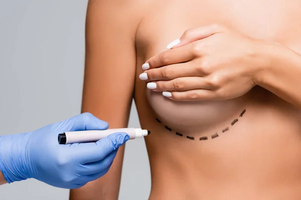 Cropped view of doctor in latex glove holding marker near naked woman with marks on breast isolated on grey — Stock Photo