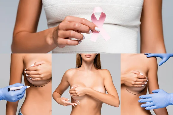 Collage de mujer desnuda con marcas en pecho y vendaje elástico sosteniendo cinta de conciencia de cáncer de mama y aplicando crema cosmética cerca del médico aislado en gris - foto de stock