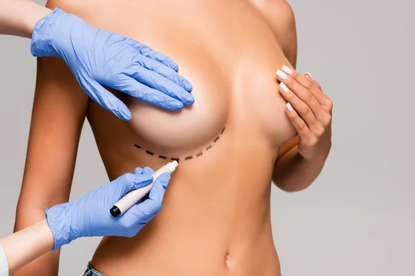 Cropped view of plastic surgeon marking line on breast of naked woman isolated on grey — Stock Photo