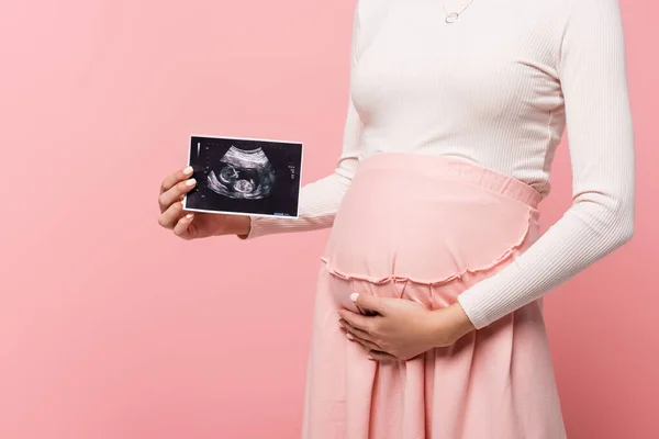 Обрезанный вид беременной женщины, держащей ультразвук, изолированный на розовом — стоковое фото