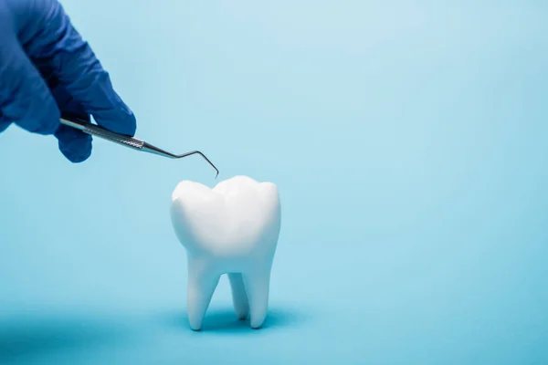 Крупный план стоматолога, держащего инструмент возле белой модели зуба на синем фоне — стоковое фото