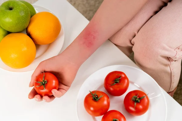 Vue recadrée de la femme allergique tenant la tomate près des fruits — Photo de stock