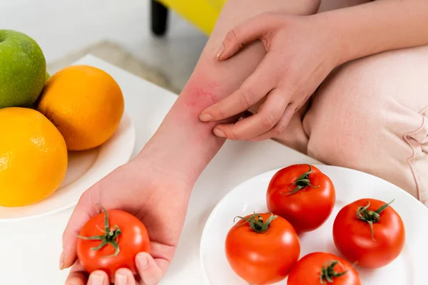 Ausgeschnittene Ansicht einer allergisch reagierenden Frau, die Tomaten in der Nähe frischer Früchte hält — Stockfoto