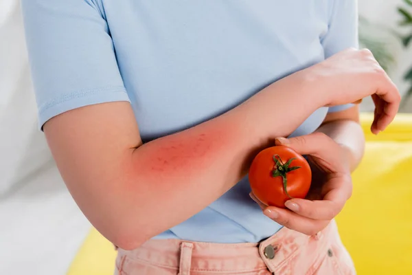 Cropped view of woman with allergy holding tomato — Stock Photo