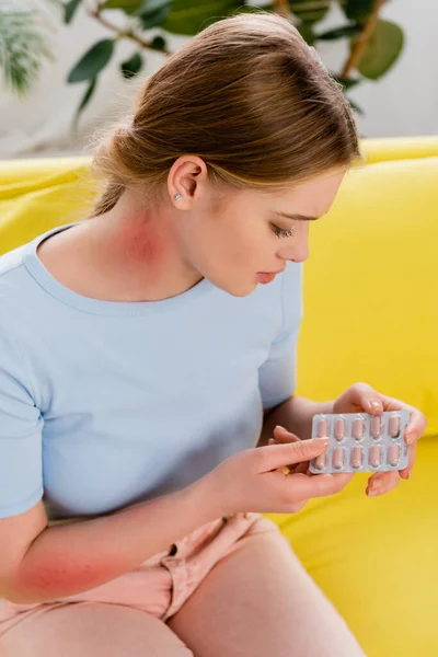 Frau mit Allergiereaktion am Hals hält Blase mit Tabletten — Stockfoto
