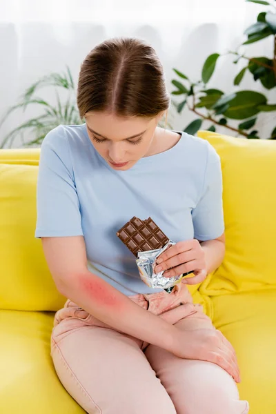 Junge Frau hält Schokoriegel in der Hand und blickt auf Allergie-Reaktion am Arm — Stockfoto