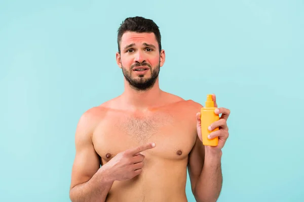 Shirtless man with sunburn pointing at sunscreen isolated on blue — Stock Photo