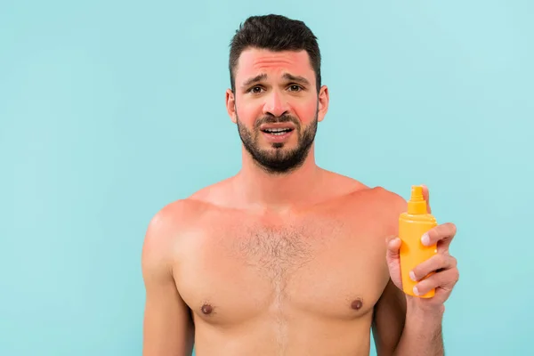 Hombre tenso con quemaduras solares sosteniendo protector solar aislado en azul - foto de stock