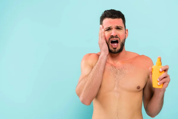 Stressed shirtless man with sunburn holding sunscreen isolated on blue — Stock Photo