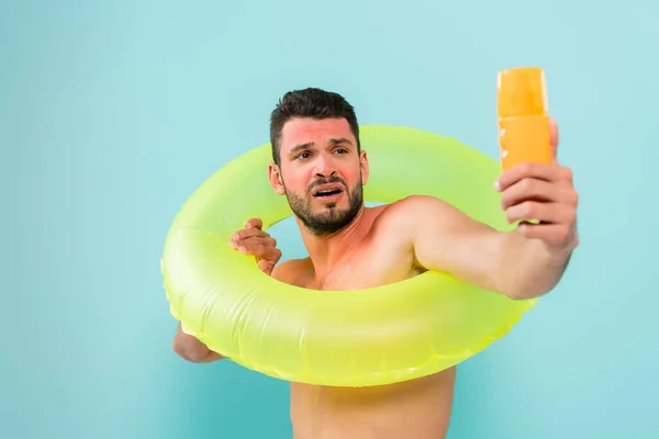 Hombre tenso con quemadura solar sosteniendo anillo inflable y protector solar aislado en azul - foto de stock