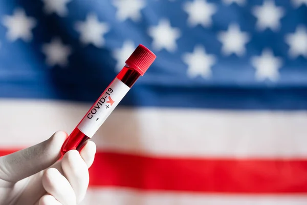 Visão cortada da pessoa em luva de látex segurando tubo de teste com resultado positivo coronavírus perto da bandeira dos EUA borrada — Fotografia de Stock