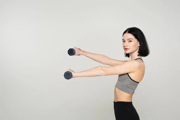 Adatta donna con allenamento vitiligine con manubri isolati su grigio — Foto stock