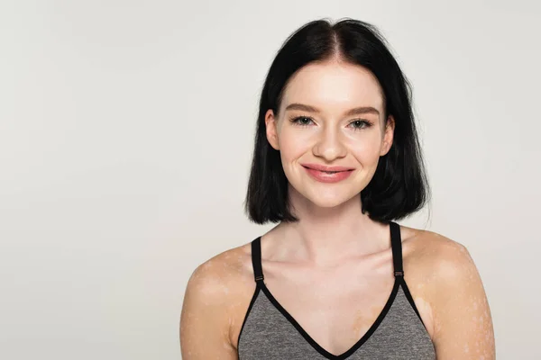 Sportswoman with vitiligo smiling at camera isolated on grey — Stock Photo