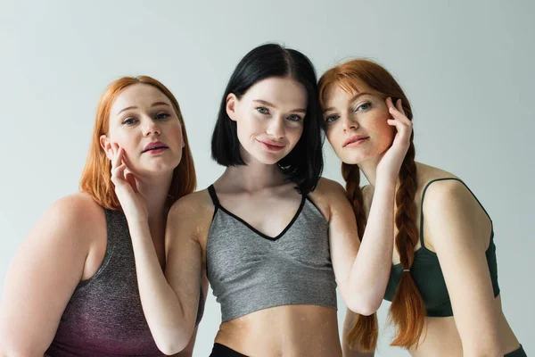 Woman with vitiligo touching faces of body positive sportswomen isolated on grey — Stock Photo