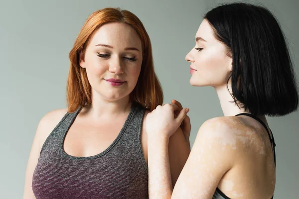 Sportswoman with vitiligo looking at plus size friend isolated on grey — Stock Photo
