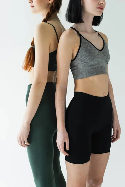 Cropped view of sportswomen with vitiligo and freckles standing back to back isolated on grey — Stock Photo