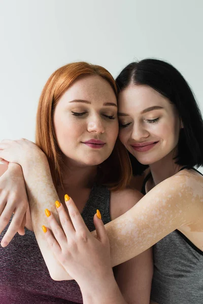 Sportswoman with vitiligo hugging plus size friend with closed eyes isolated on grey — Stock Photo