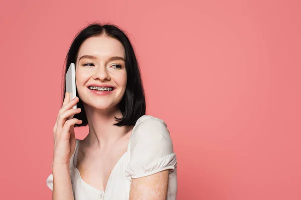 Smiling woman with vitiligo talking on mobile phone isolated on pink — Stock Photo