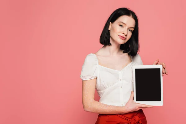 Pretty woman with vitiligo holding digital tablet with blank screen isolated on pink — Stock Photo