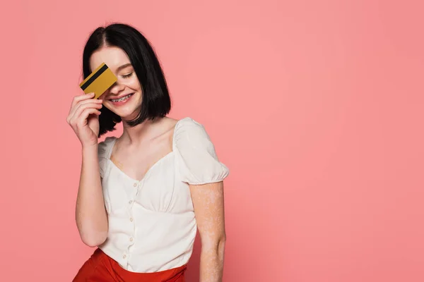 Lächelnde Frau mit Vitiligo hält Kreditkarte in der Nähe Gesicht auf rosa Hintergrund — Stockfoto