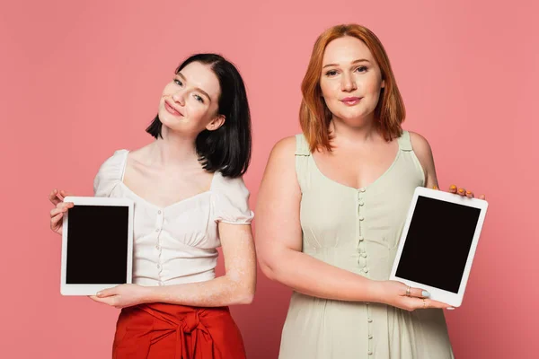 Mulheres positivas para o corpo segurando comprimidos digitais com tela em branco em fundo rosa — Fotografia de Stock