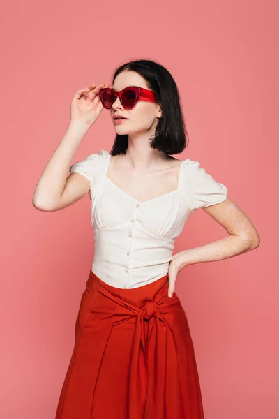 Femme élégante avec vitiligo tenant des lunettes de soleil isolées sur rose — Photo de stock