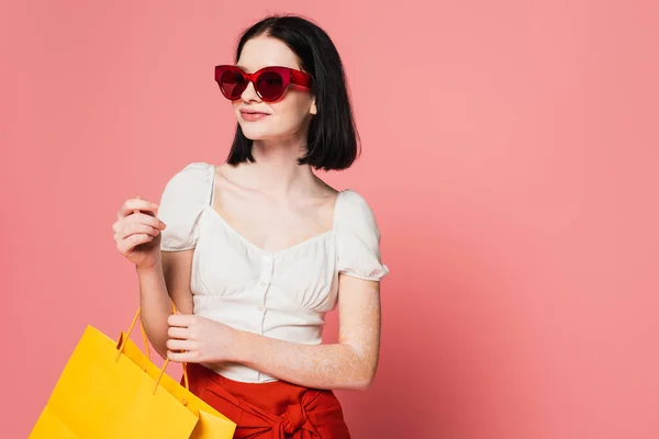 Stilvolle Frau mit Vitiligo hält Einkaufstasche isoliert auf rosa — Stockfoto