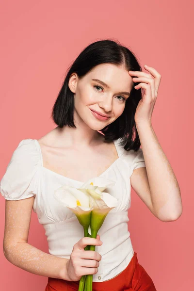 Mulher sorridente com vitiligo segurando lírios calla isolados em rosa — Fotografia de Stock