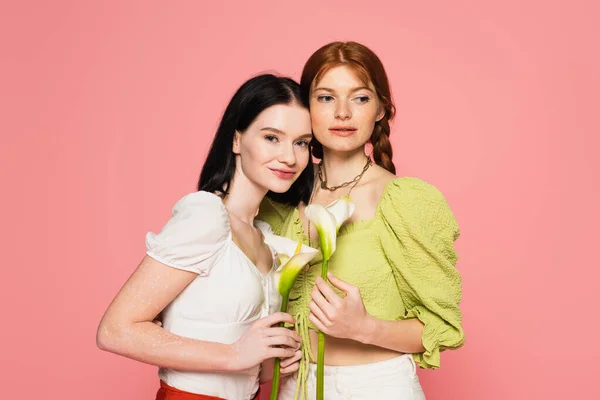 Femmes avec taches de rousseur et vitiligo tenant des fleurs isolées sur rose — Photo de stock