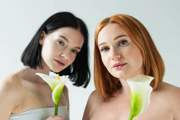 Plus size and woman with vitiligo holding calla lilies isolated on grey — Stock Photo