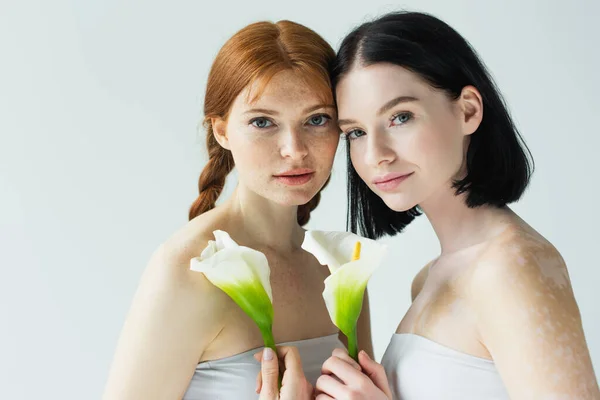 Body positive women with freckles and vitiligo holding flowers isolated on grey — Stock Photo