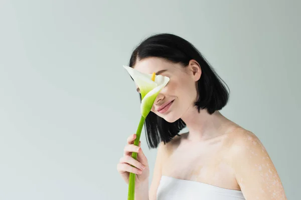 Woman with vitiligo covering face with calla lily isolated on grey — Stock Photo