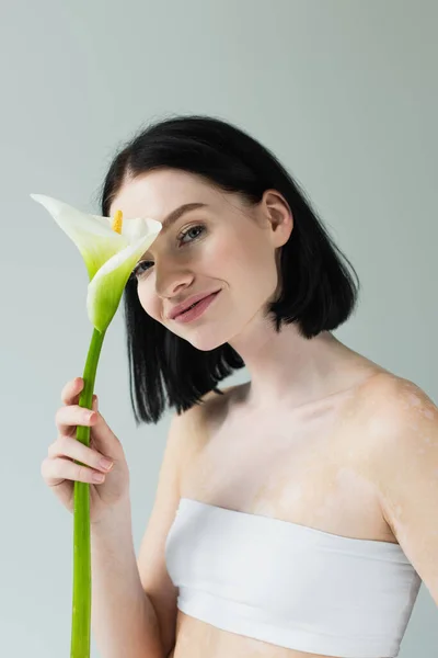 Smiling woman with vitiligo holding calla lily isolated on grey — Stock Photo