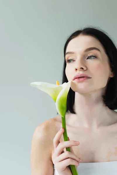 Mujer con vitiligo sosteniendo flor de calla y mirando hacia otro lado aislado en gris - foto de stock