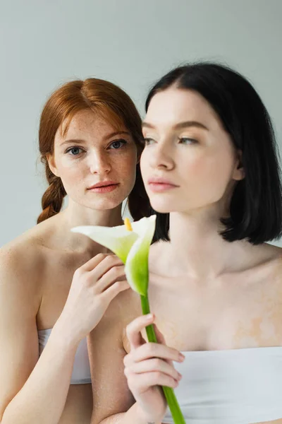 Freckled woman hugging friend with vitiligo and flower on blurred foreground isolated on grey — Stock Photo