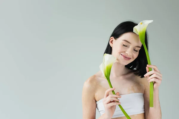 Усміхнена жінка з вітіліго тримає квіти кали ізольовані на сірому — стокове фото
