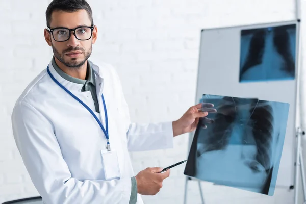 Junge Ärztin mit Brille zeigt auf Lungen-Röntgen, während sie in die Kamera schaut — Stockfoto