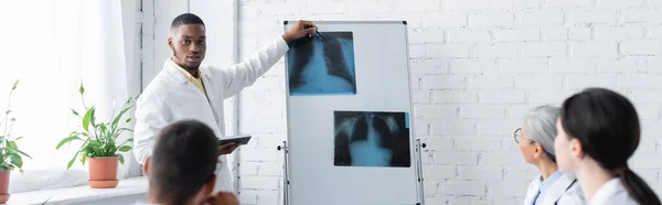 Афроамериканський лікар вказує на рентгенівські промені легень на фліп-чарті під час ради з розмитими колегами, банер — стокове фото