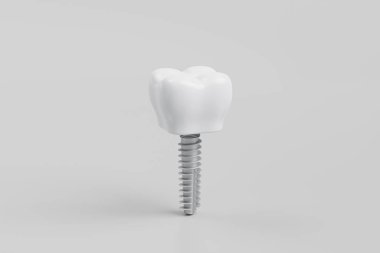 Gri arka planda diş implantı. 3d hazırlayıcı