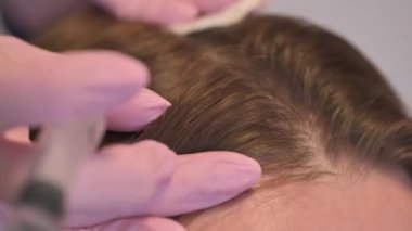 Güzellik uzmanları saç dökülmesini önlemek ya da yavaşlatmak için kadın derisine vitamin ve mineral enjekte eder.