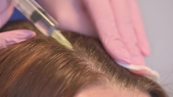 Un esteticista hace inyecciones de vitaminas y minerales en el cuero cabelludo de las mujeres, para prevenir o ralentizar la pérdida de cabello — Vídeos de Stock