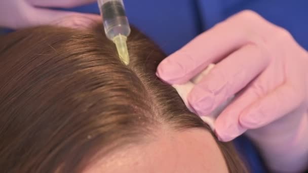 Güzellik uzmanları saç dökülmesini önlemek ya da yavaşlatmak için kadın derisine vitamin ve mineral enjekte eder. — Stok video