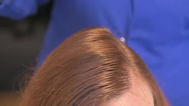 Косметолог делает инъекции витаминов и минералов в женскую кожу головы, чтобы предотвратить или замедлить выпадение волос — стоковое видео