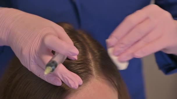 Egy kozmetikus vitaminokat és ásványi anyagokat fecskendez a fejbőrbe, hogy megelőzze vagy lelassítsa a hajhullást. — Stock videók