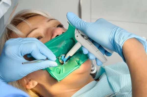 Dentist with patient, cleaning and curing — Stock Photo, Image