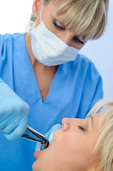 Extração dentária — Fotografia de Stock