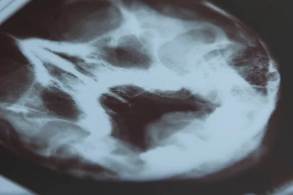Radiografía Los Senos Nasales Primer Plano Control Enfermedades Purulentas Crónicas — Foto de Stock
