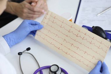 Doktorlar hastanın oturduğu yerdeki kardiyogramın sonucunu tutuyor.